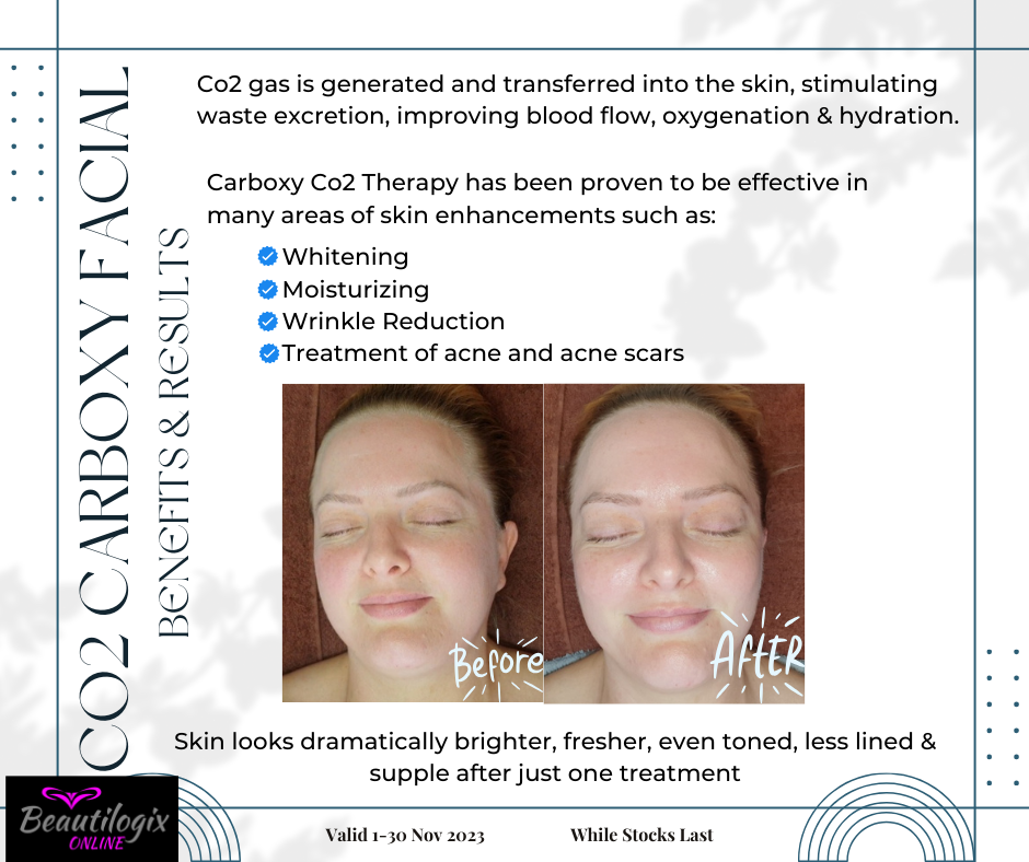 CO2 Carboxy Facial Kit 2 - 5x Single Treatment 25ml + 5x CO2 Masks + 5x 2ml Post Moisturizer Sachets - Image 2